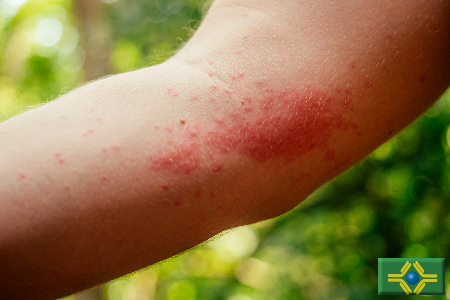 AdobeStock 313196866