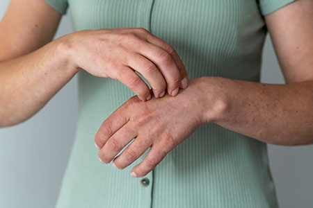 O Projeto Brasil sem Alergia oferece gratuitamente, em todas as suas unidades no Rio de Janeiro, testes para avaliação e prevenção de alergia de pele