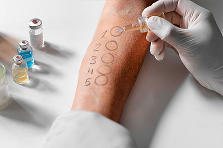 O Projeto Brasil sem Alergia oferece gratuitamente, em todas as suas unidades no Rio de Janeiro, testes para avaliação e prevenção de alergias alimentares