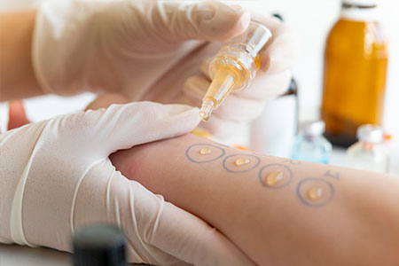 teste de alergia